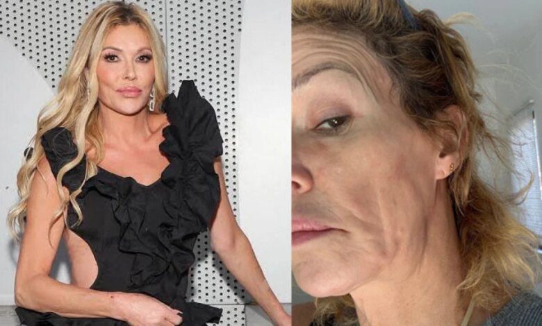 Brandi Glanville ‘شرمندہ’ فنڈ ریزر کی مدد قبول کرنے پر